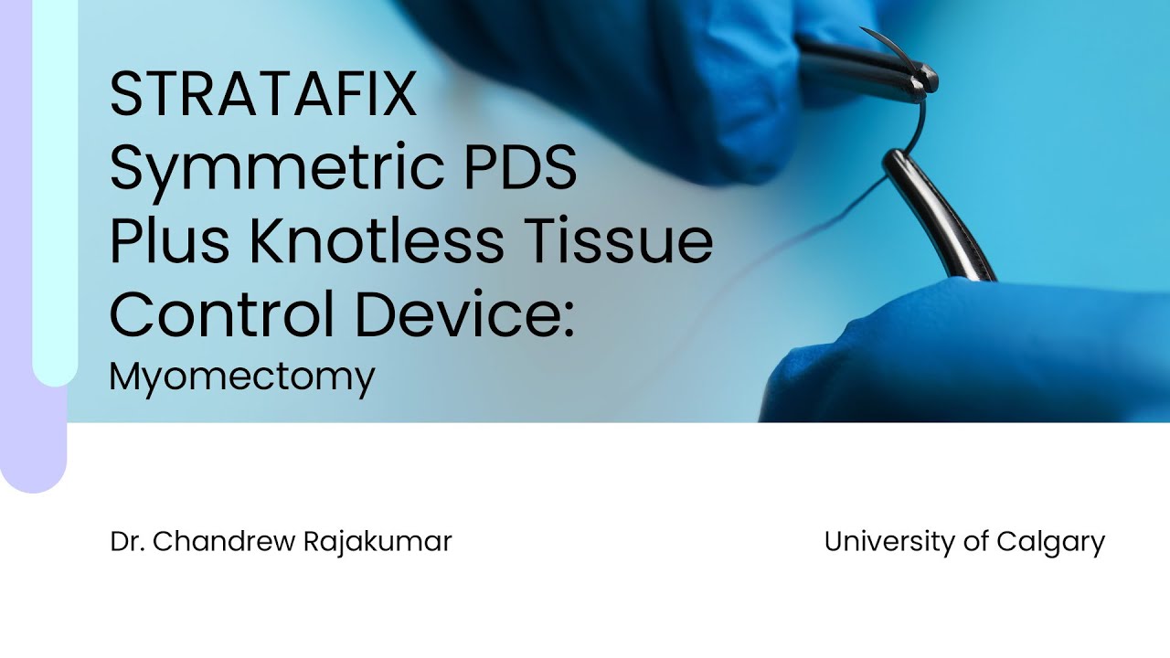 STRATAFIX Symmetric PDS Plus Knotless Tissue Control Device Myomectomy