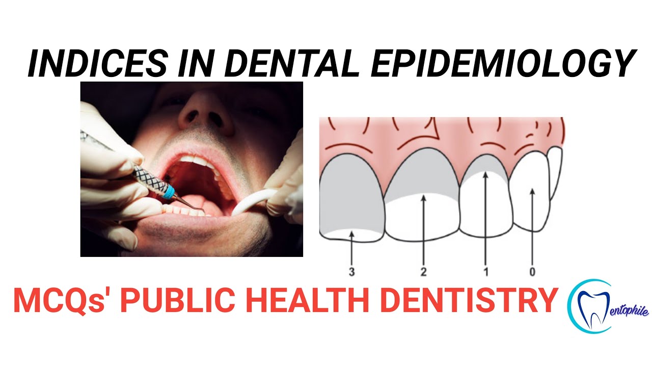 MCQs on Indices in Dental Epidemiology || Community Dentistry || Dentophile