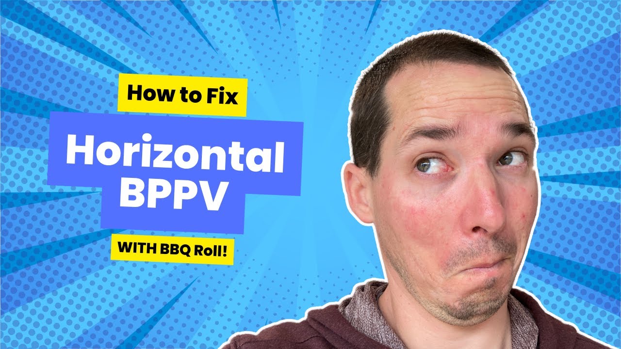 How to Perform BBQ Roll for Horizontal Canal BPPV