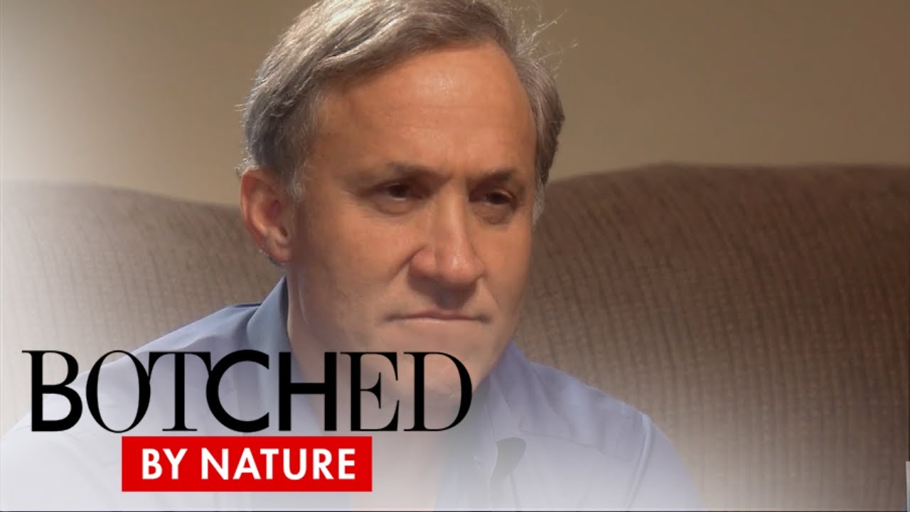 Botched by Nature | 