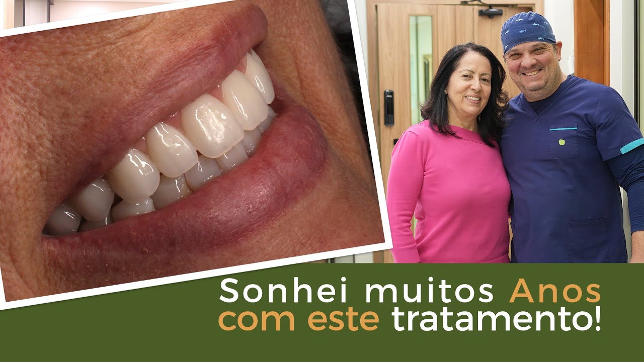 Sonhei Muitos Anos com a Prótese Protocolo - Implace Implantes