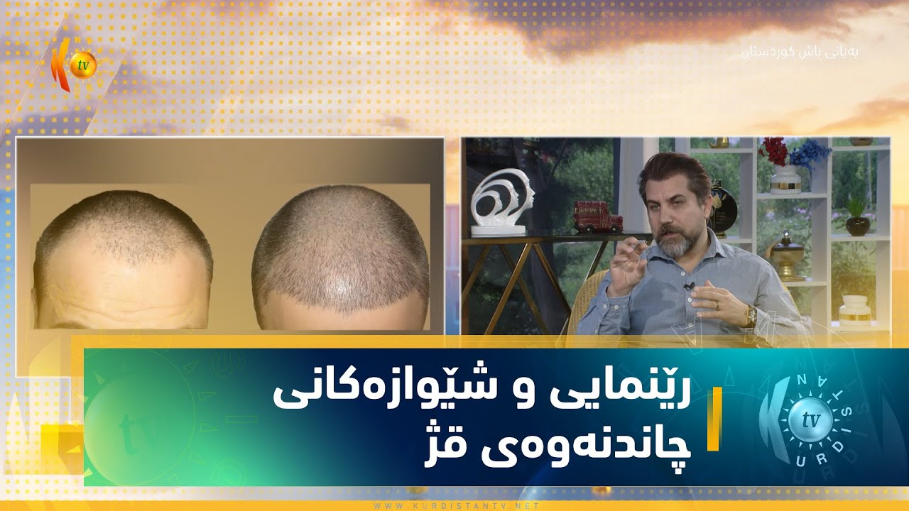 رێنمایی و شێوازەكانی چاندنەوەی قژ