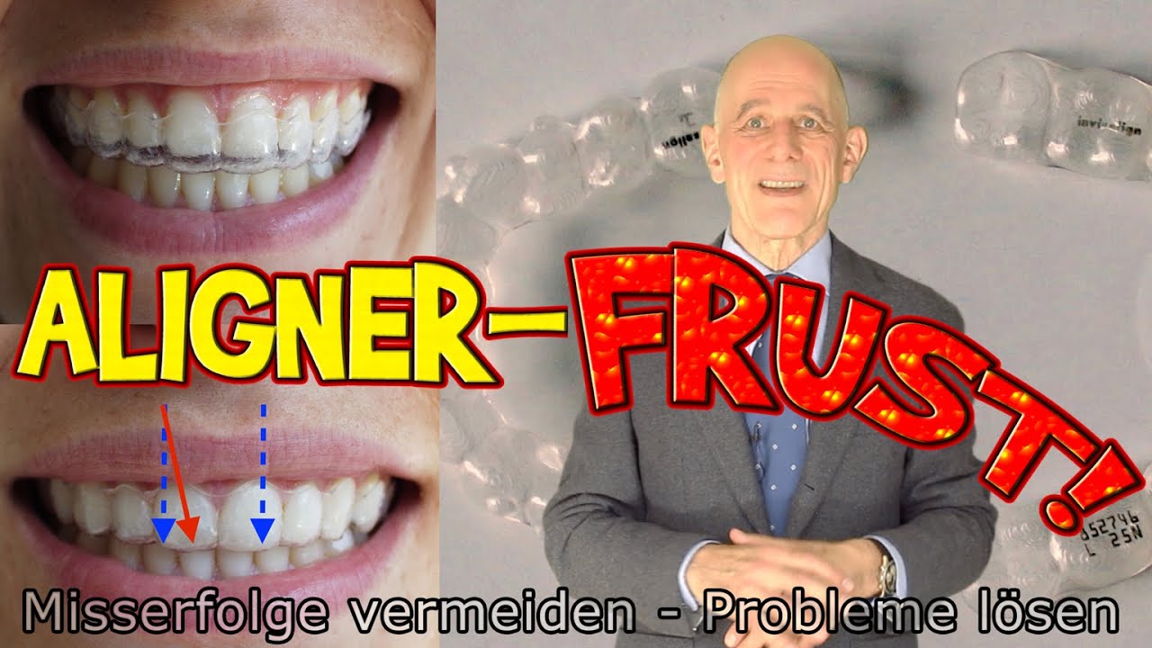Aligner-Frust: Troubleshooting und Krisenmanagement wenn's mit Ihrer Zahnspange nicht richtig klappt