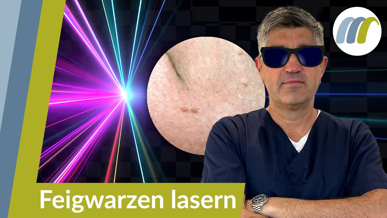 Laserbehandlung bei Feigwarzen im Genitalbereich: So werden sie effektiv & dauerhaft entfernt!