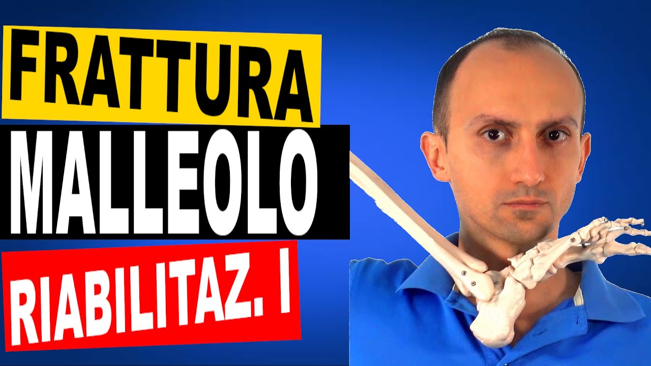 Riabilitazione dopo Frattura del Malleolo - Prima Parte