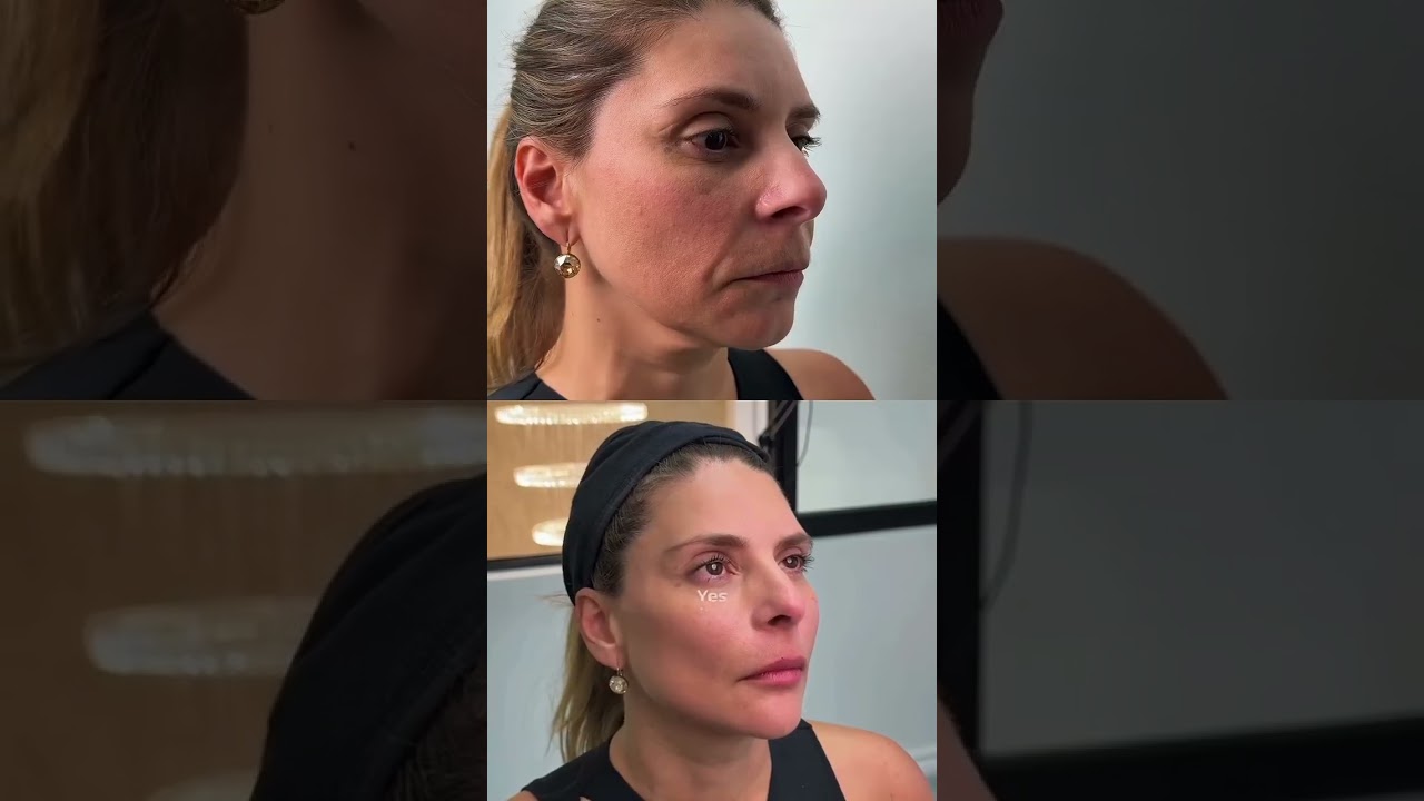 Advanced Surgical Techniques with Dr. Daniel Diaz Torrado A Step-by-Step Guide