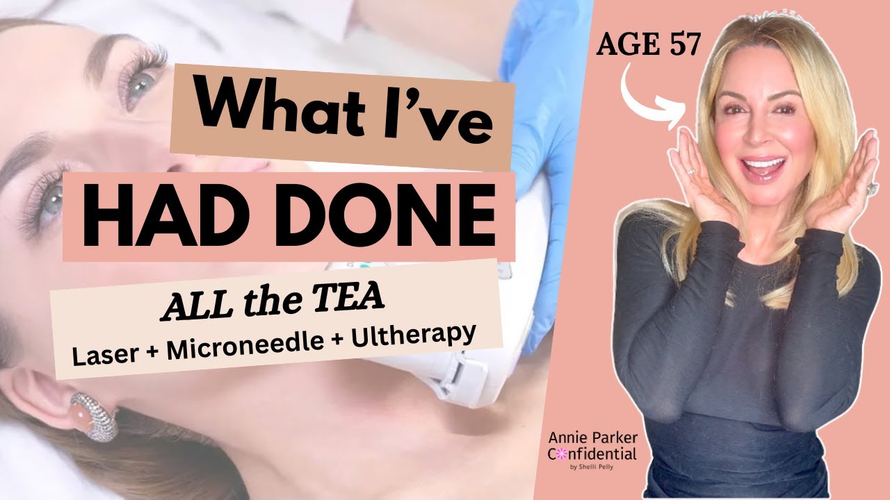What I’ve Had Done: Laser, Microneedle, Surgery