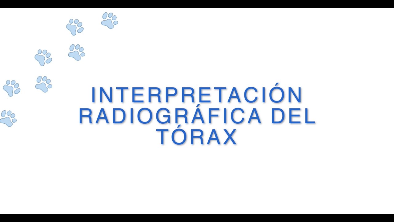 interpretación radiográfica del tórax