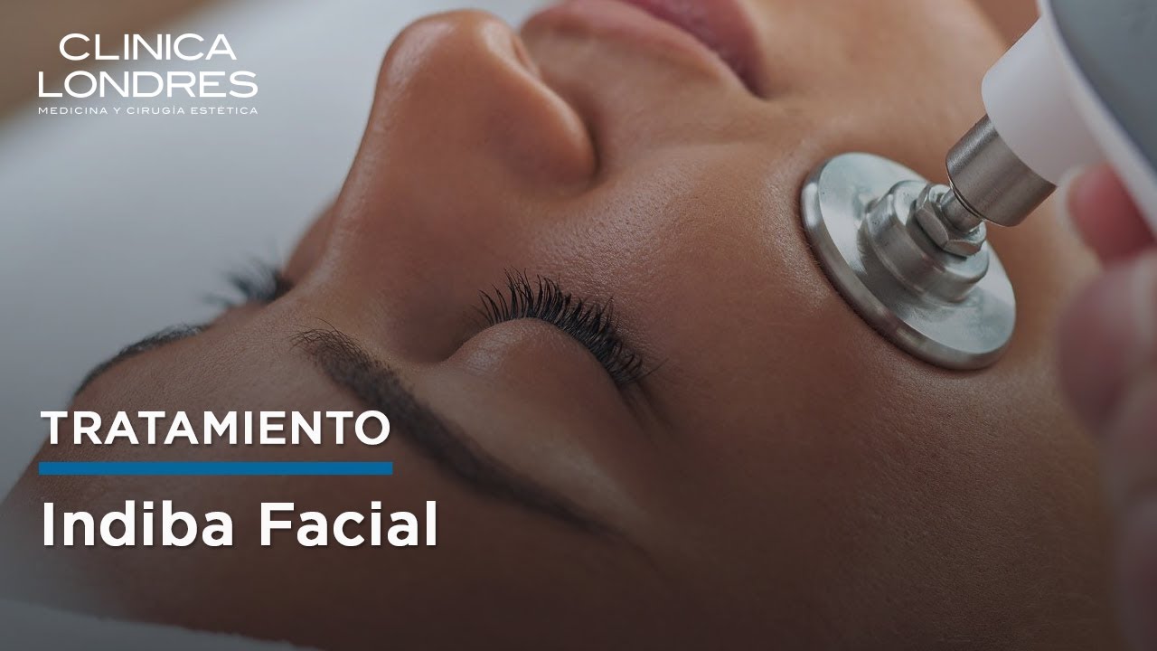 Tratamiento Indiba Facial. Sesión en vivo