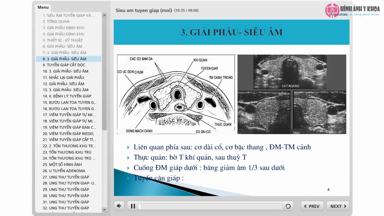 17. Siêu âm tuyến giáp - TS. Vũ Đăng Lưu (SIÊU ÂM TỔNG QUÁT BỆNH VIỆN BẠCH MAI)