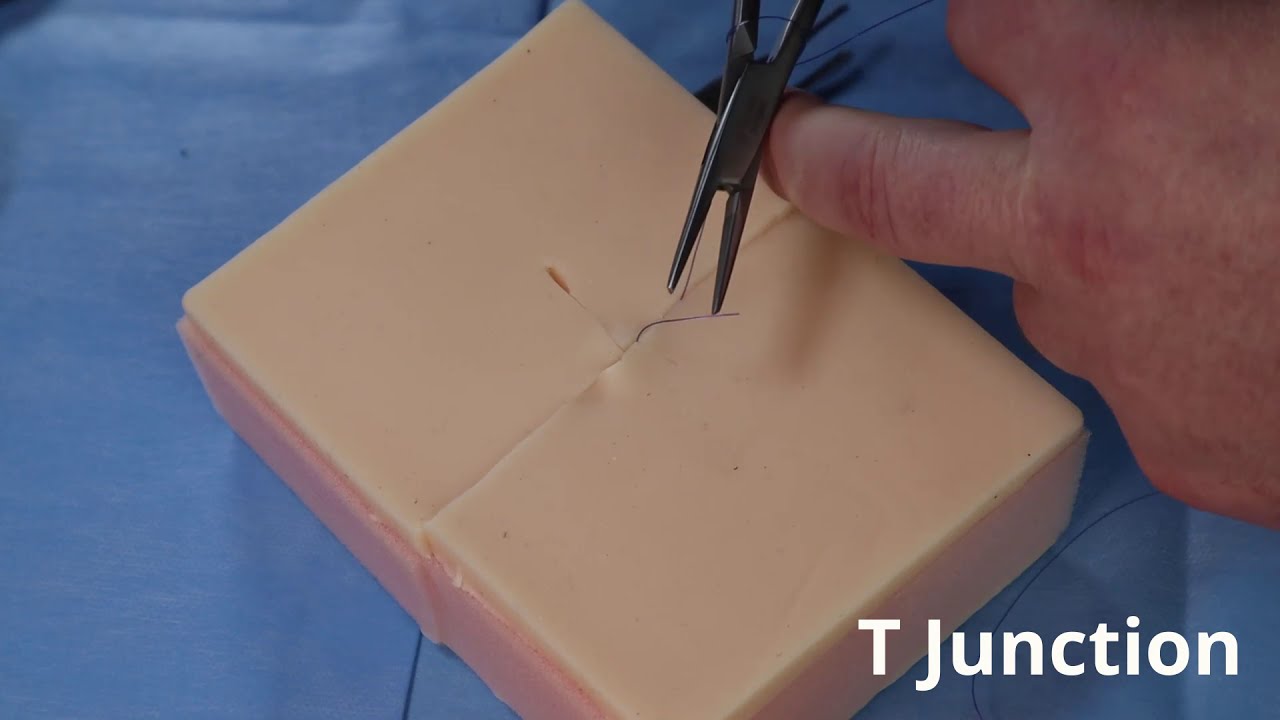 Suturing a T Junction
