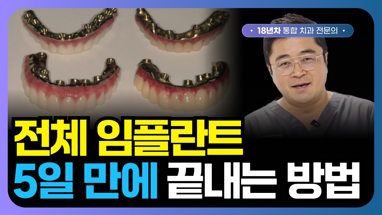 전체 임플란트, 5일 만에 끝내는 방법