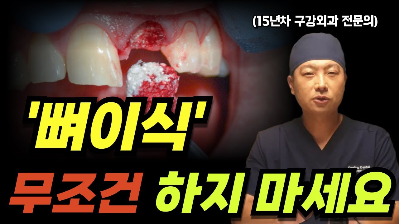 치과에서 뼈이식 강요하면 이렇게 대답하세요! 임플란트 사기 안 당합니다!