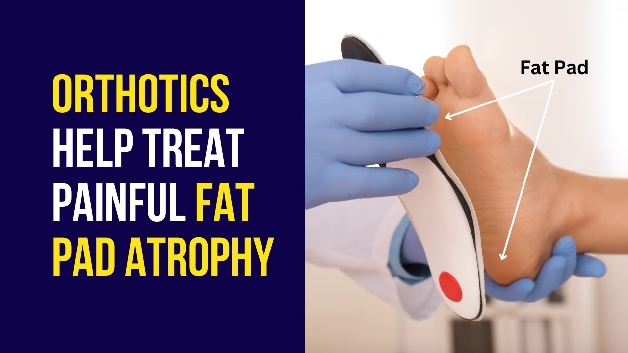 How Orthotics Help in Painful Foot Fat Pad Atrophy Treatment