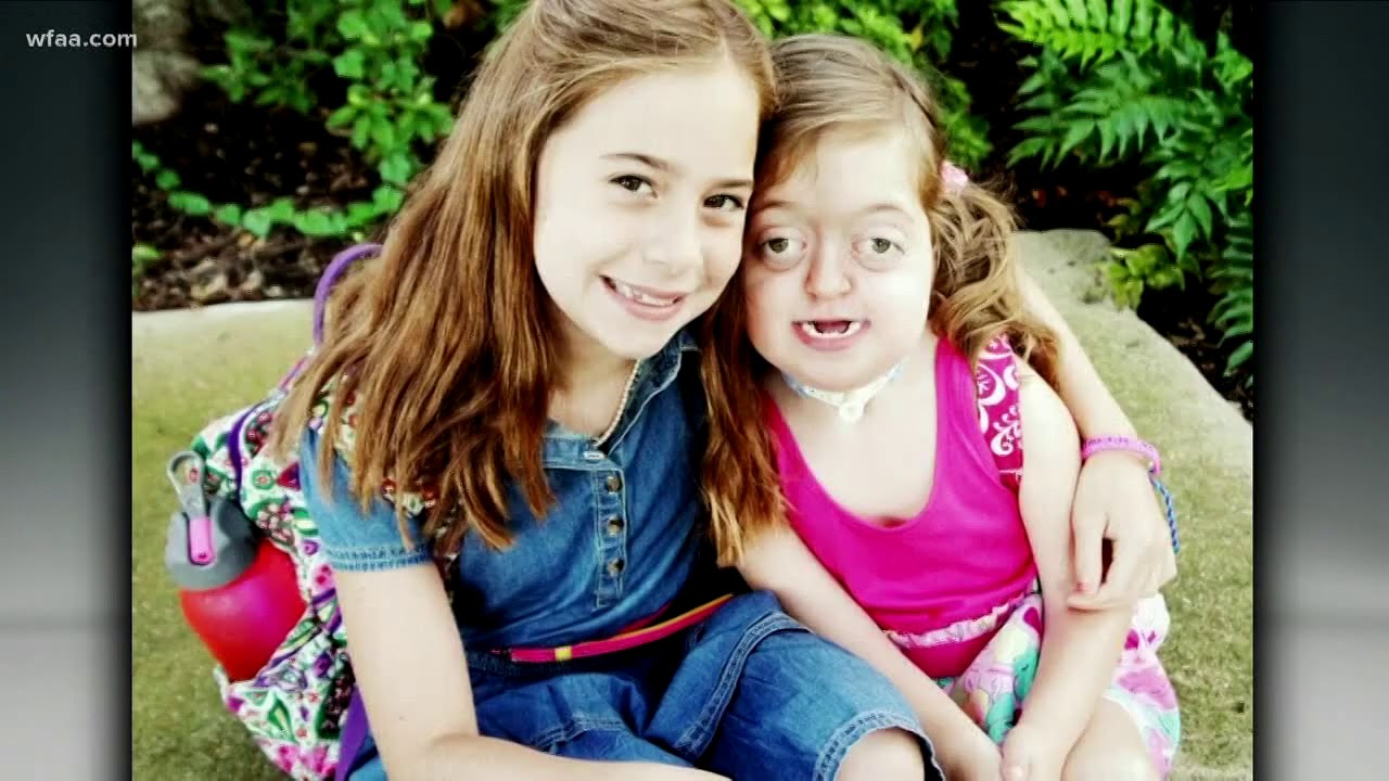 The reality of living with facial deformities
