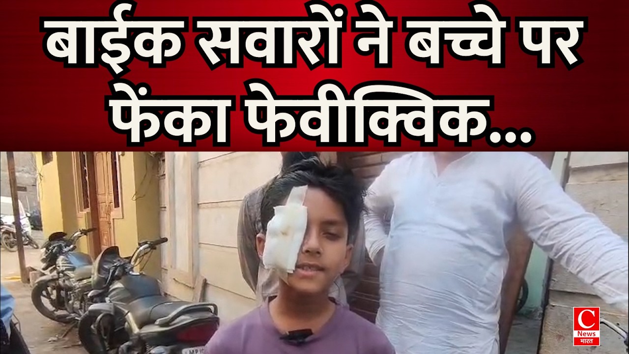 खरगोन में बाईक सवारों ने बच्चे पर फेंका फेवीक्विक, मचा हड़कंप|| Cnews Bharat