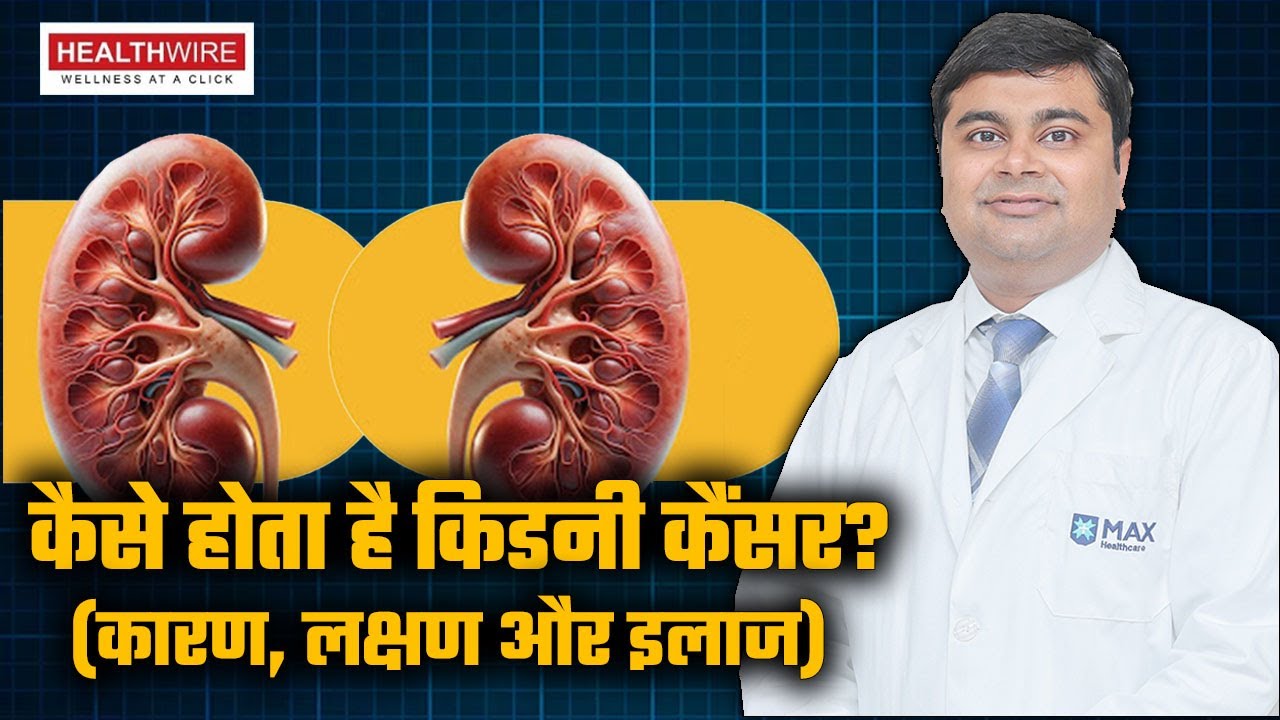 किडनी कैंसर का ये लक्षण भूलकर भी न करे Ignore | Kidney Cancer Symptoms | Kidney Cancer Treatment