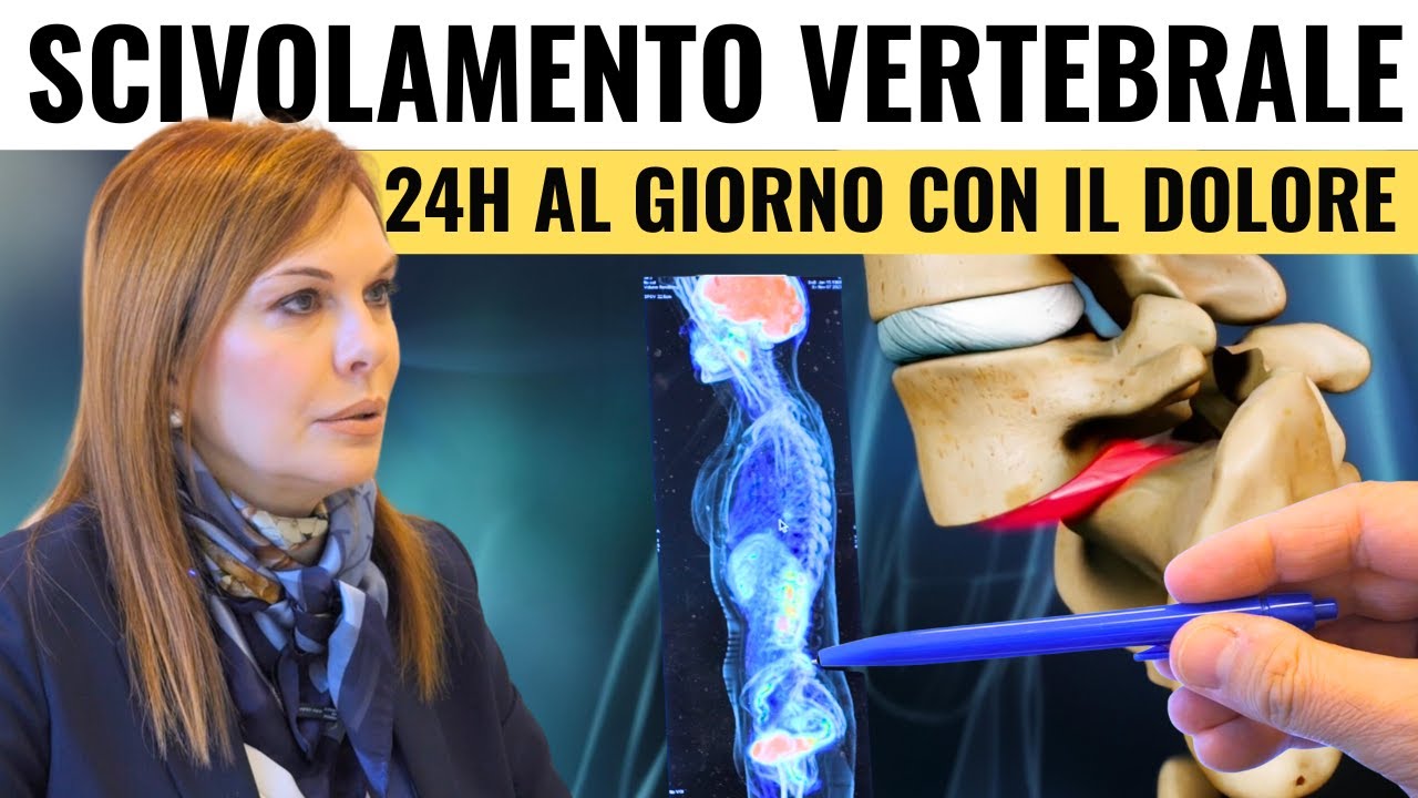 La Listesi Vertebrale: Una Storia Vera su una Condizione Spesso Non Riconosciuta ma Risolvibile