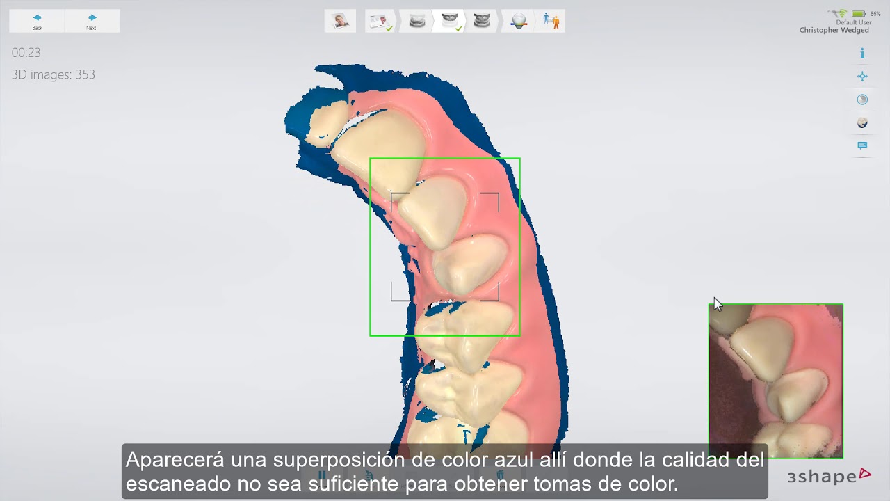 3Shape TRIOS - Shade measurement ES