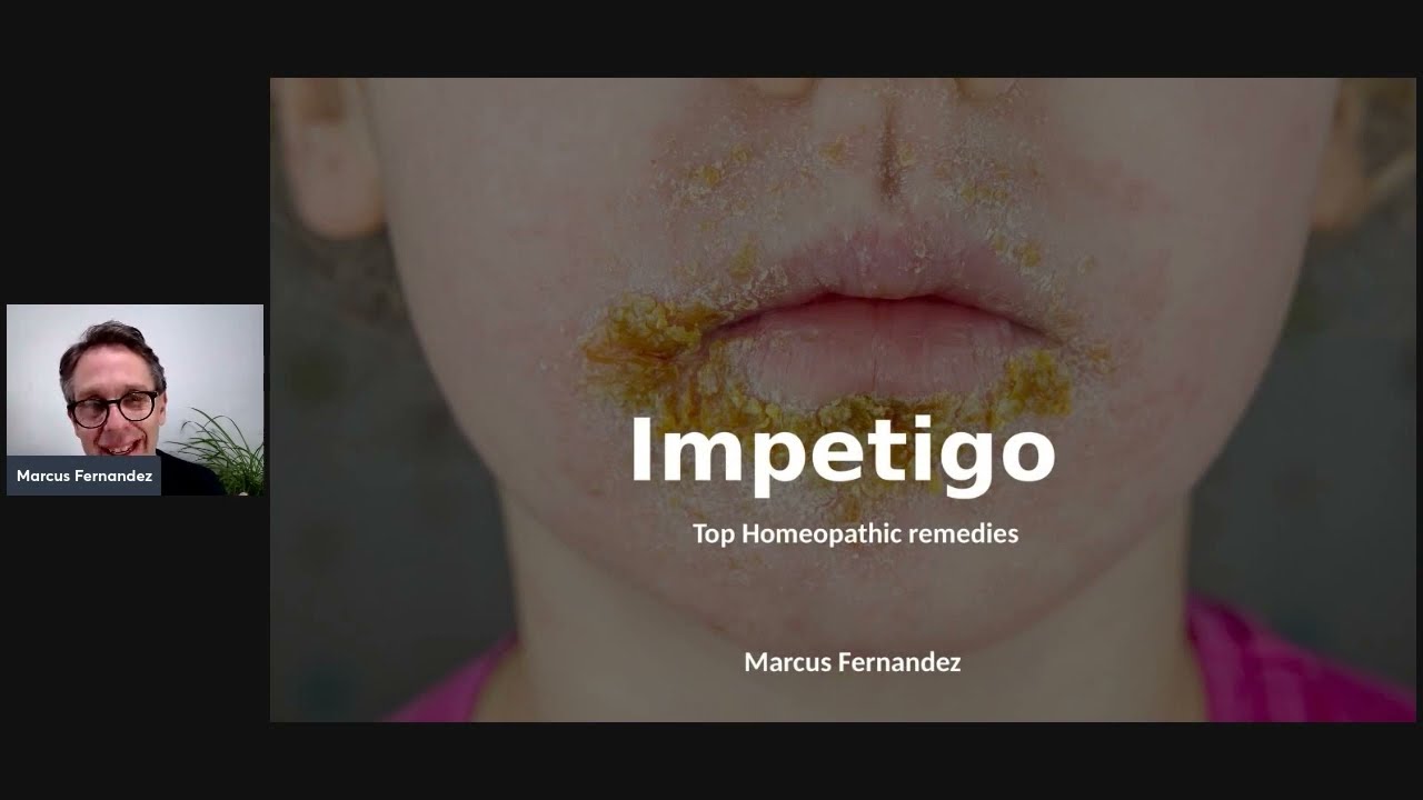 HOMEOPATHY FOR IMPETIGO