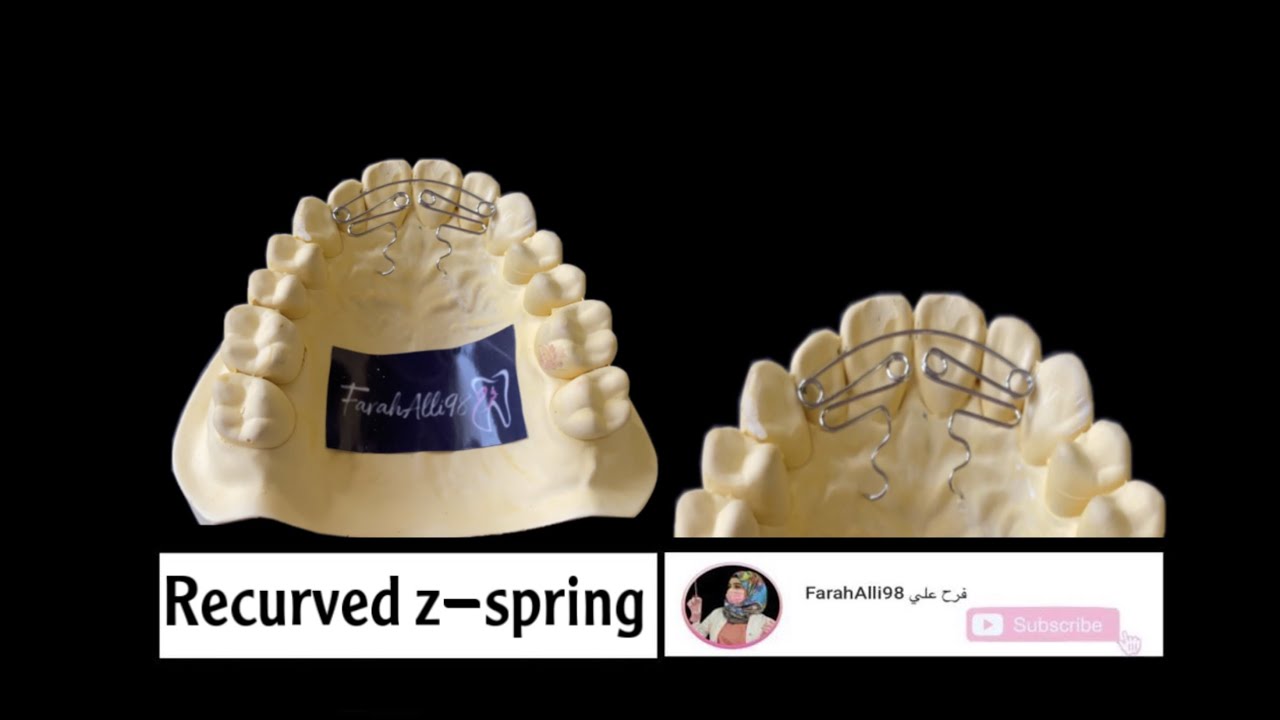 Recurved Z Spring Bending -z spring orthodontics - zspring #FarahAlli98 #فرح_علي