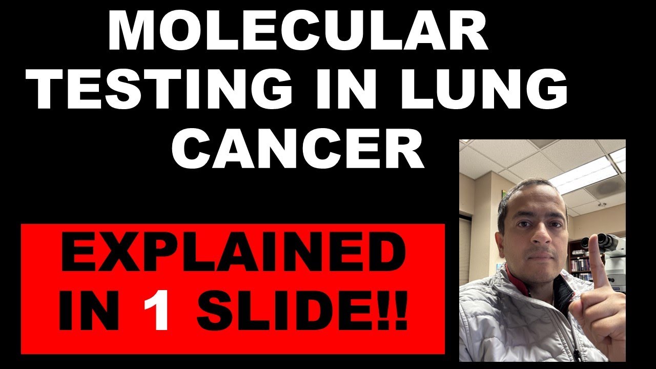 Molecular testing in lung cancer explained in 1 slide by a thoracic pathologist