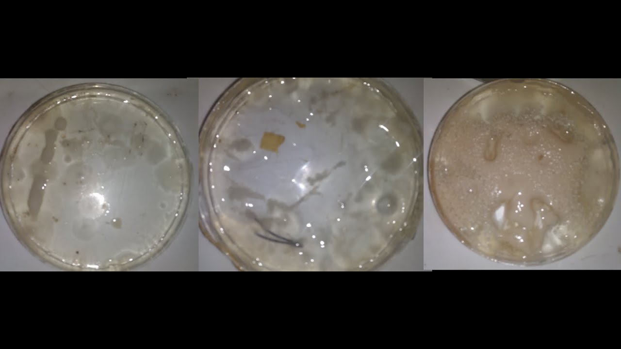 Culturing yeast on agar (petri plates)