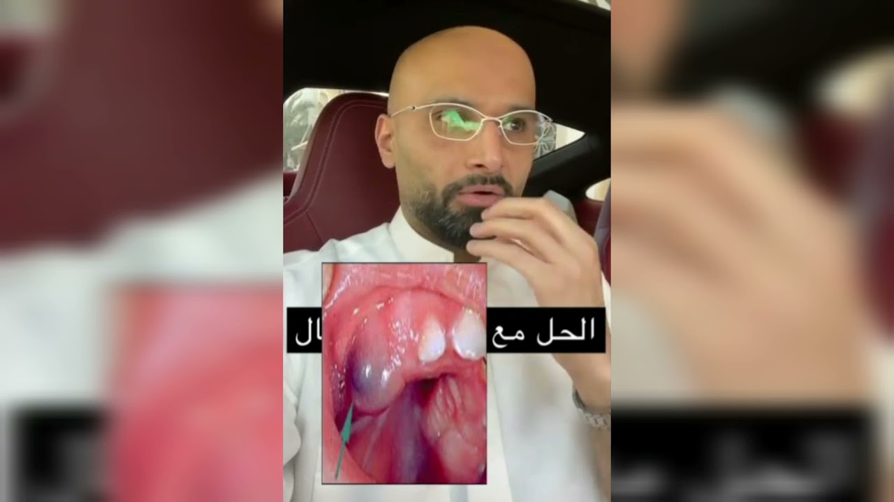 تسنين الأطفال: العلامات والعلاج | الدكتور محمد الصفي