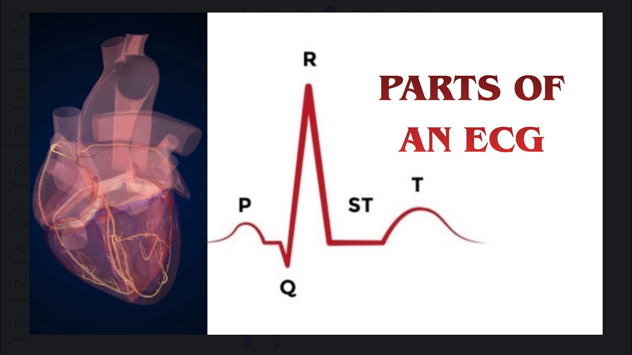 Parts of an ECG | EKG Basics | Waves Segments Intervals | Cardiac Physiology #nursing #educational 