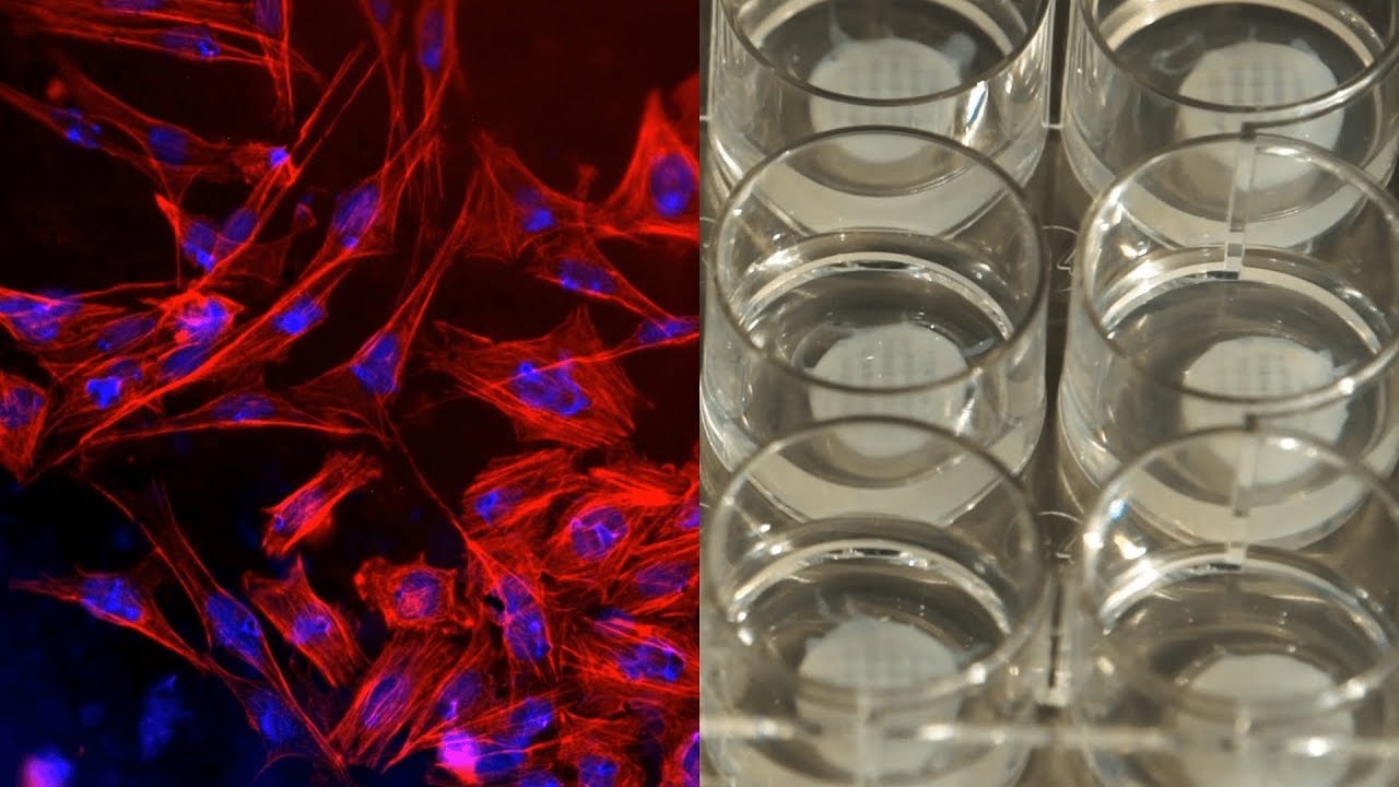 Transformation of Amorphous Polyphosphate Nanoparticles into Coacervate Complexes