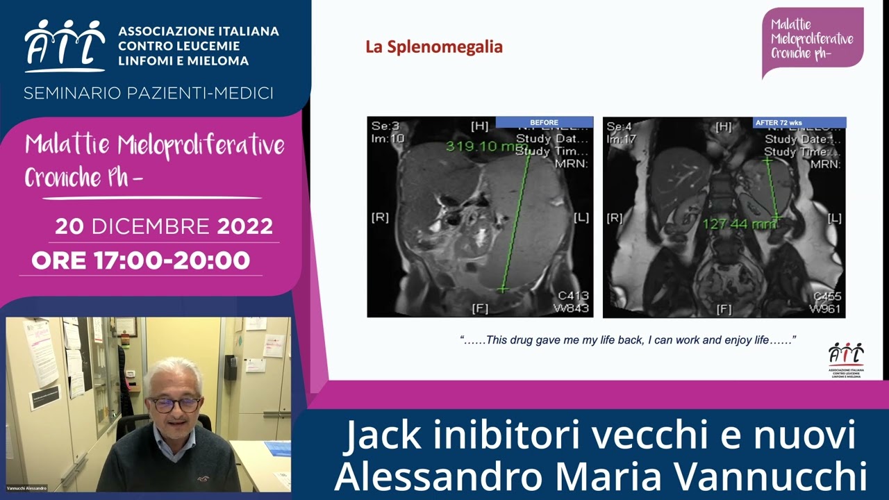 Jack inibitori vecchi e nuovi