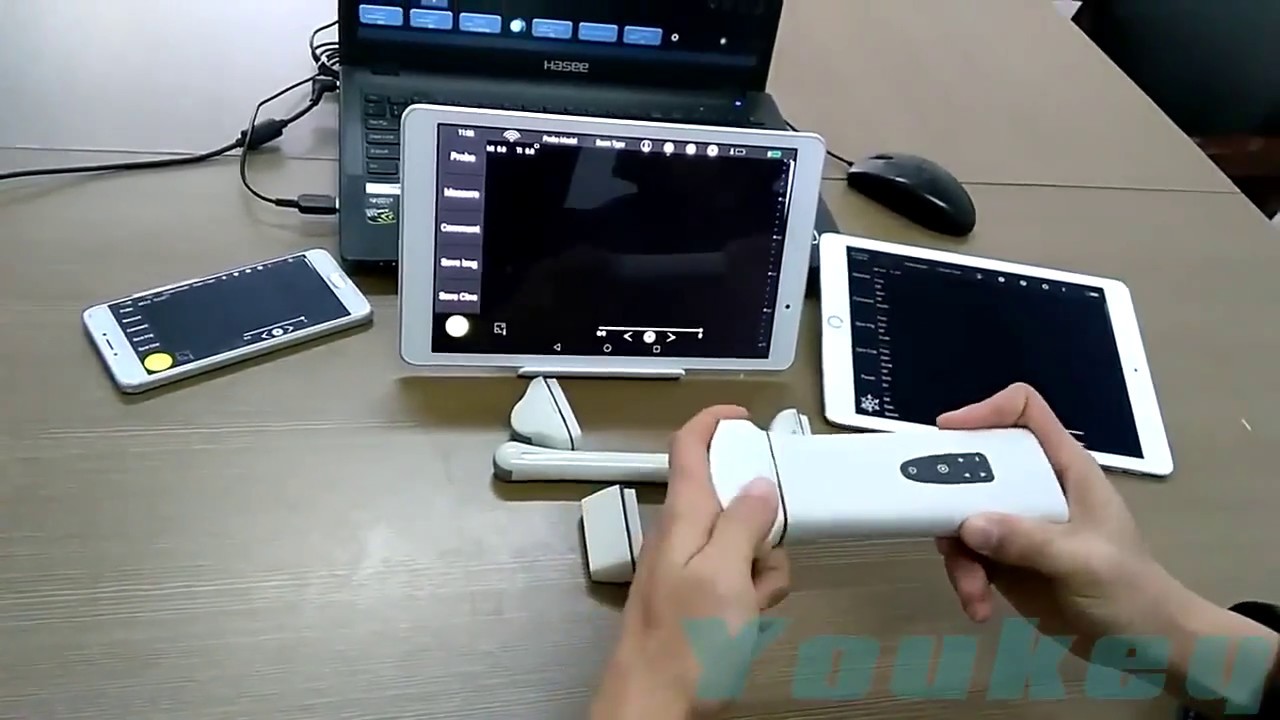 Youkey WiFi Wireless Pocket Ultrasound system D8 Introduction s