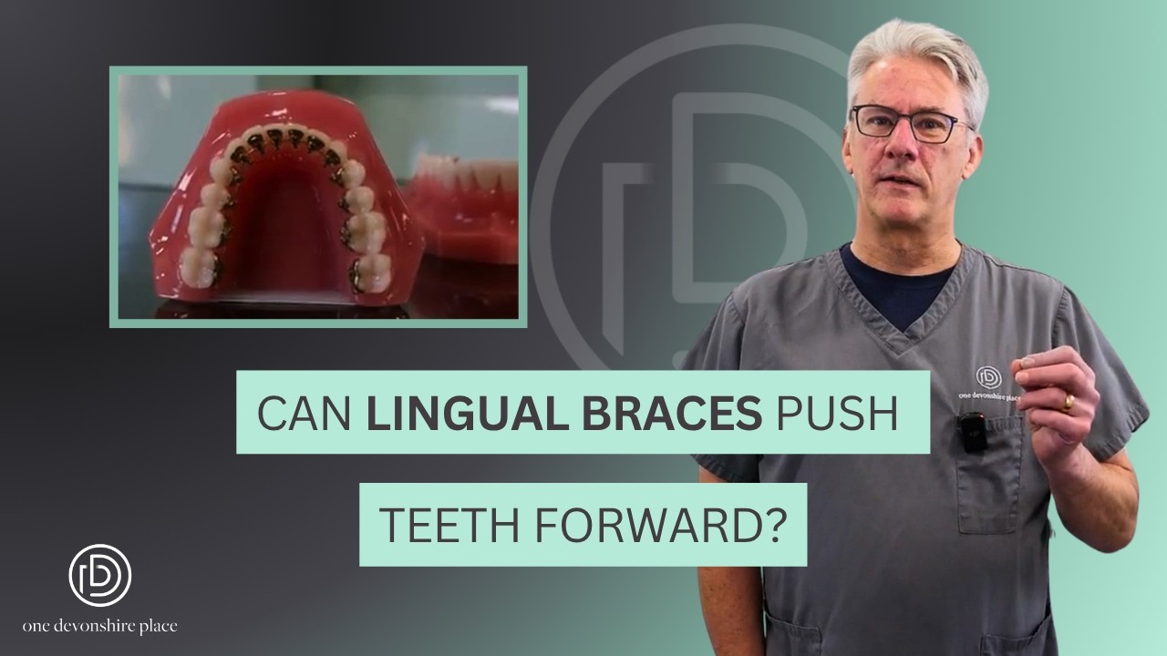 Can LINGUAL BRACES push teeth forward?
