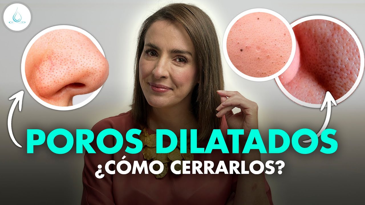 🔴 Como CERRAR los POROS ABIERTOS, DILATADOS y PUNTOS NEGROS @drapilarochoa - Dermatologa