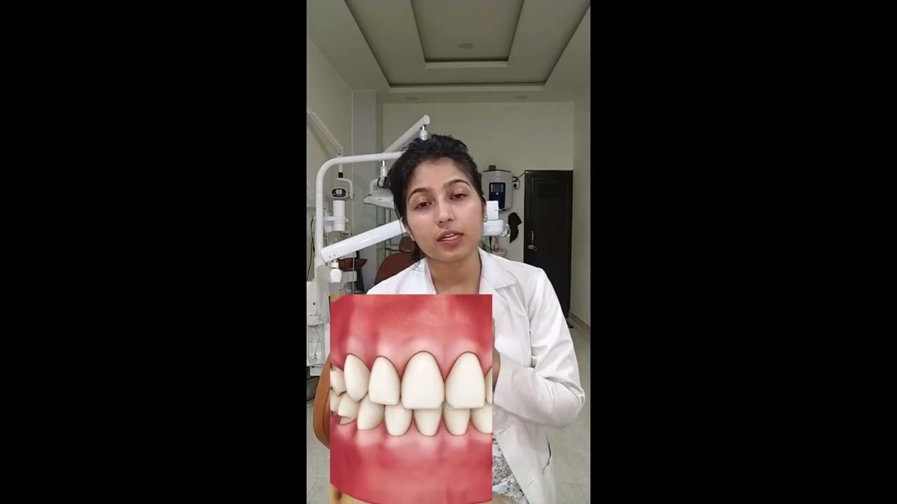 Hard Brushing and Oral Jewellery can DAMAGE your TEETH #oralhealthtips #smiledesigndental