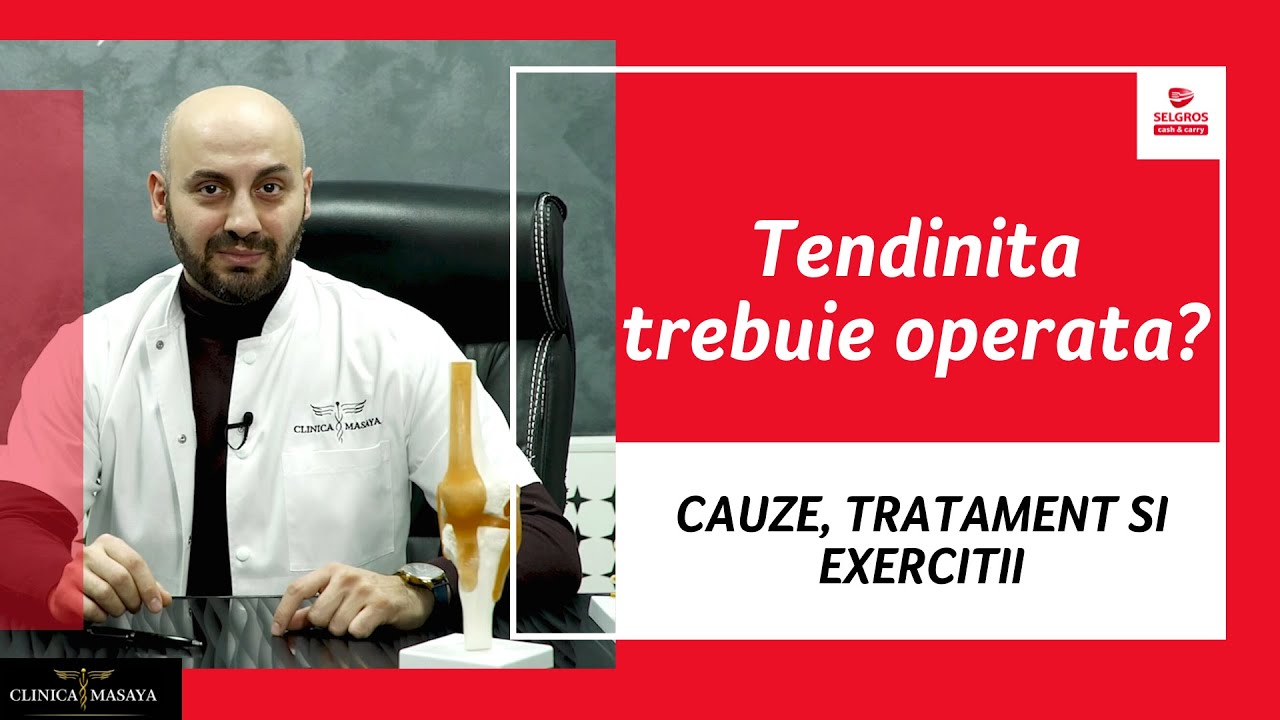Tendinita: Tratament si 2 Exercitii UTILE pentru Recuperare