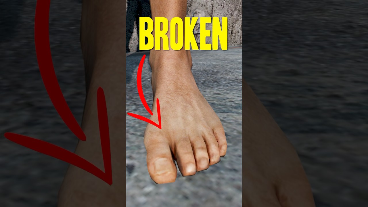 The Worst DayZ Mistake&hellip; 🦴