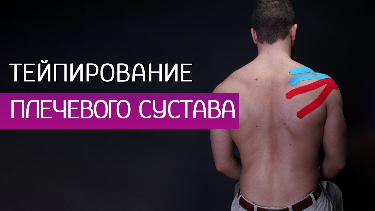 Терапия боли в плече - тейпирование