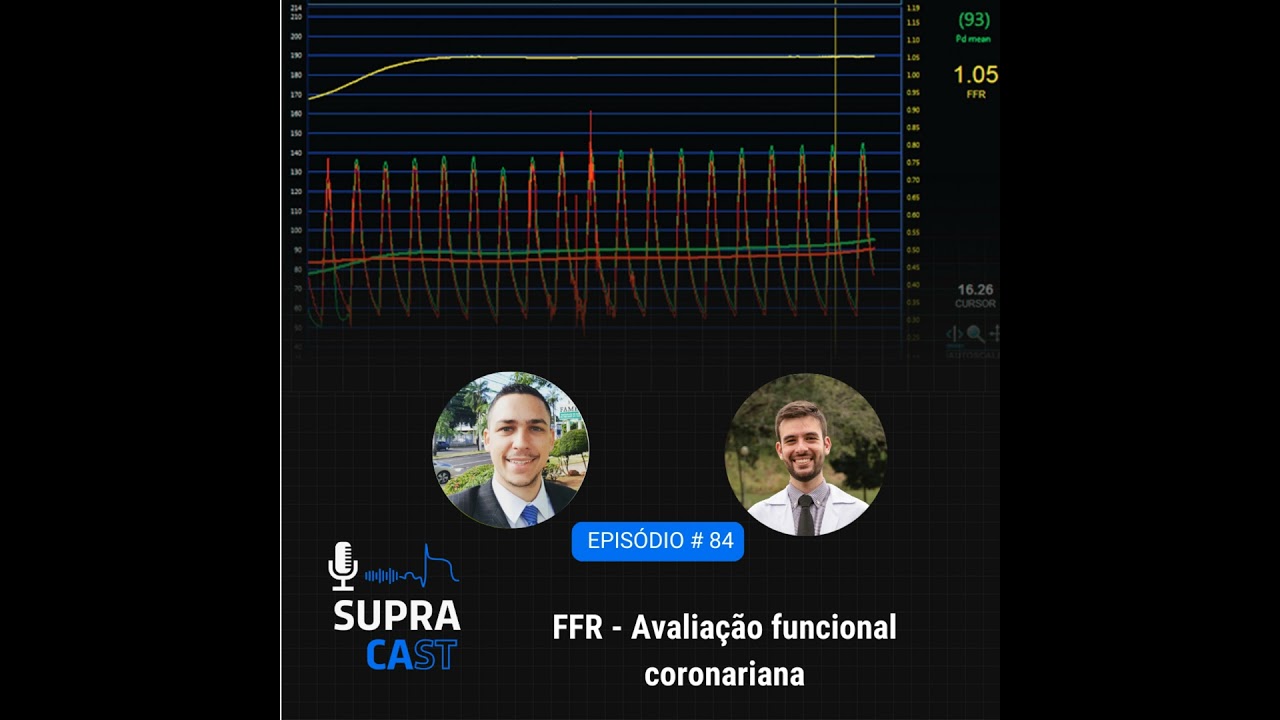 84. FFR Avaliação Funcional Coronariana