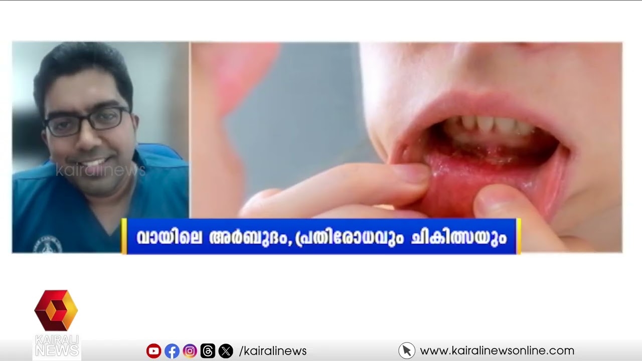വായിലെ അർബുദം എത്രത്തോളം അപകടകരമാണ്; എങ്ങനെ പ്രതിരോധിക്കാം| HELLO DOCTOR | MOUTH CANCER