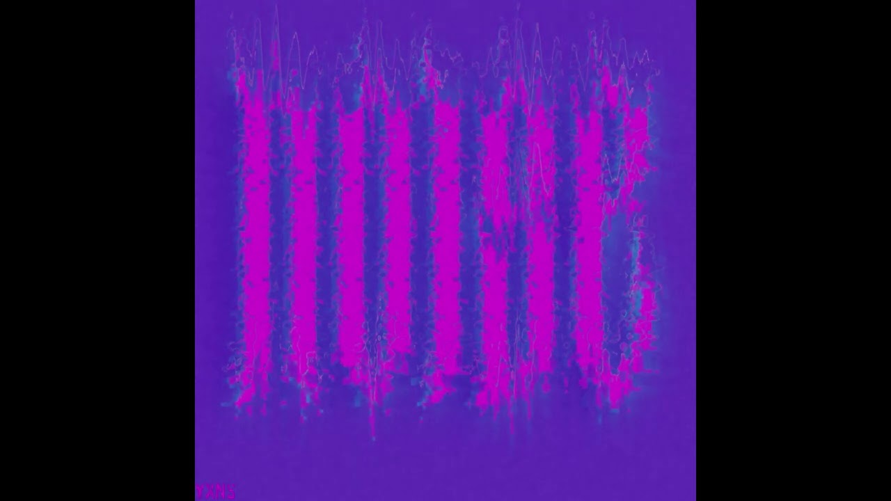 NOISE YXN$ - UNME
