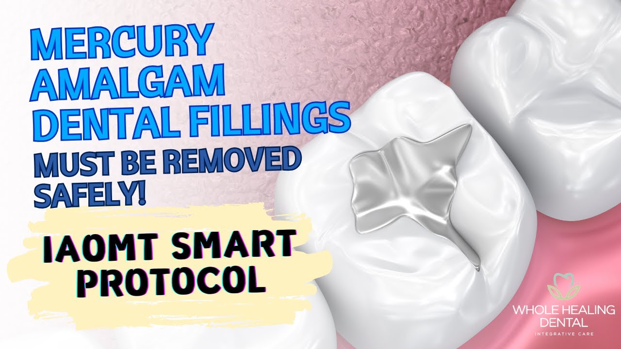 IAOMT SMART Protocol - Mercury Amalgam Dental Fillings must be removed safely!