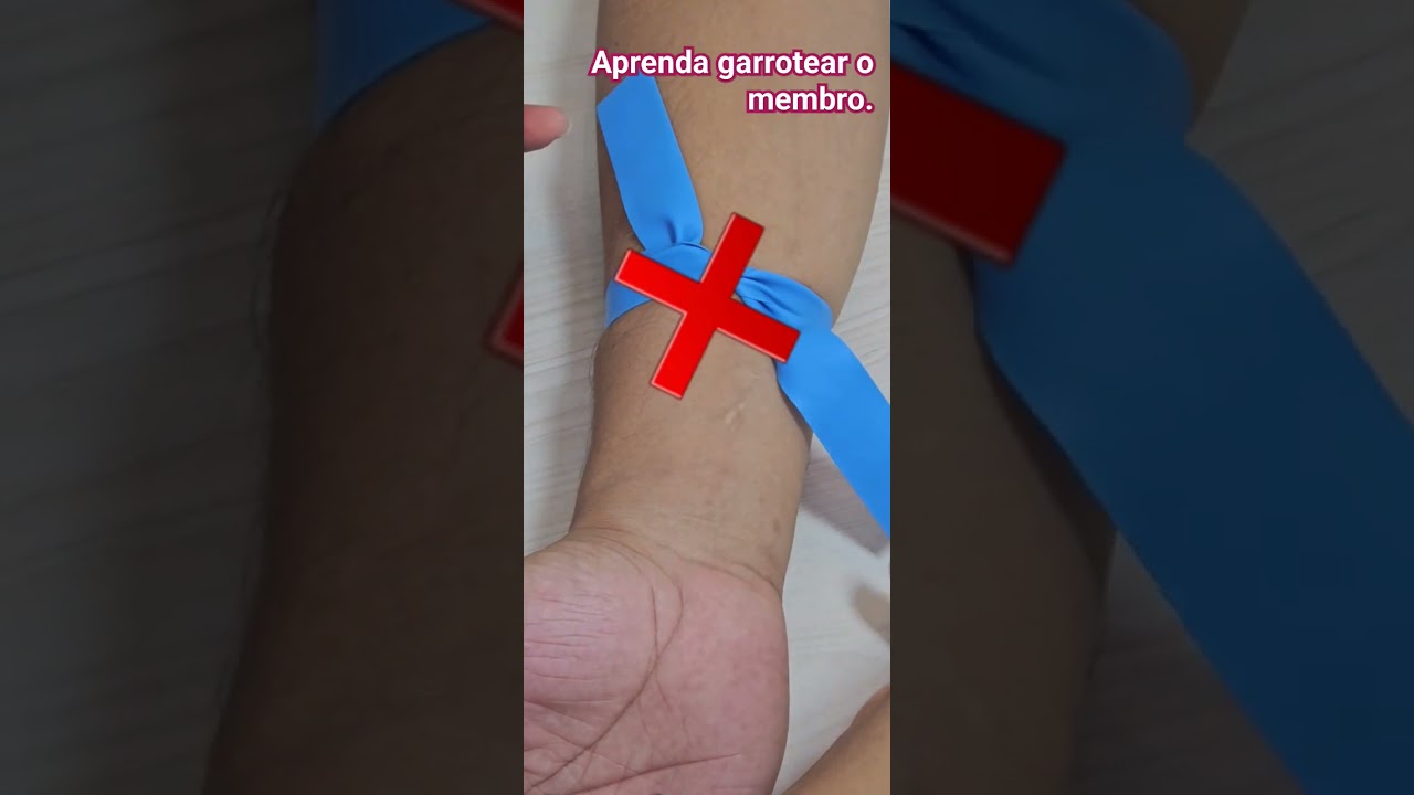 Garrotear Corretamente para Acesso Venoso Perif&eacute;rico. #enfermagem #centrocirurgico #saude