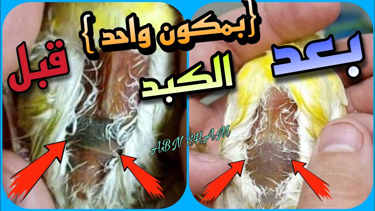 مرض الكبد علاج طبيعي دليل 👆 داخل الفيديو بصوت وصورة عند الكناري والحسون والبادجي