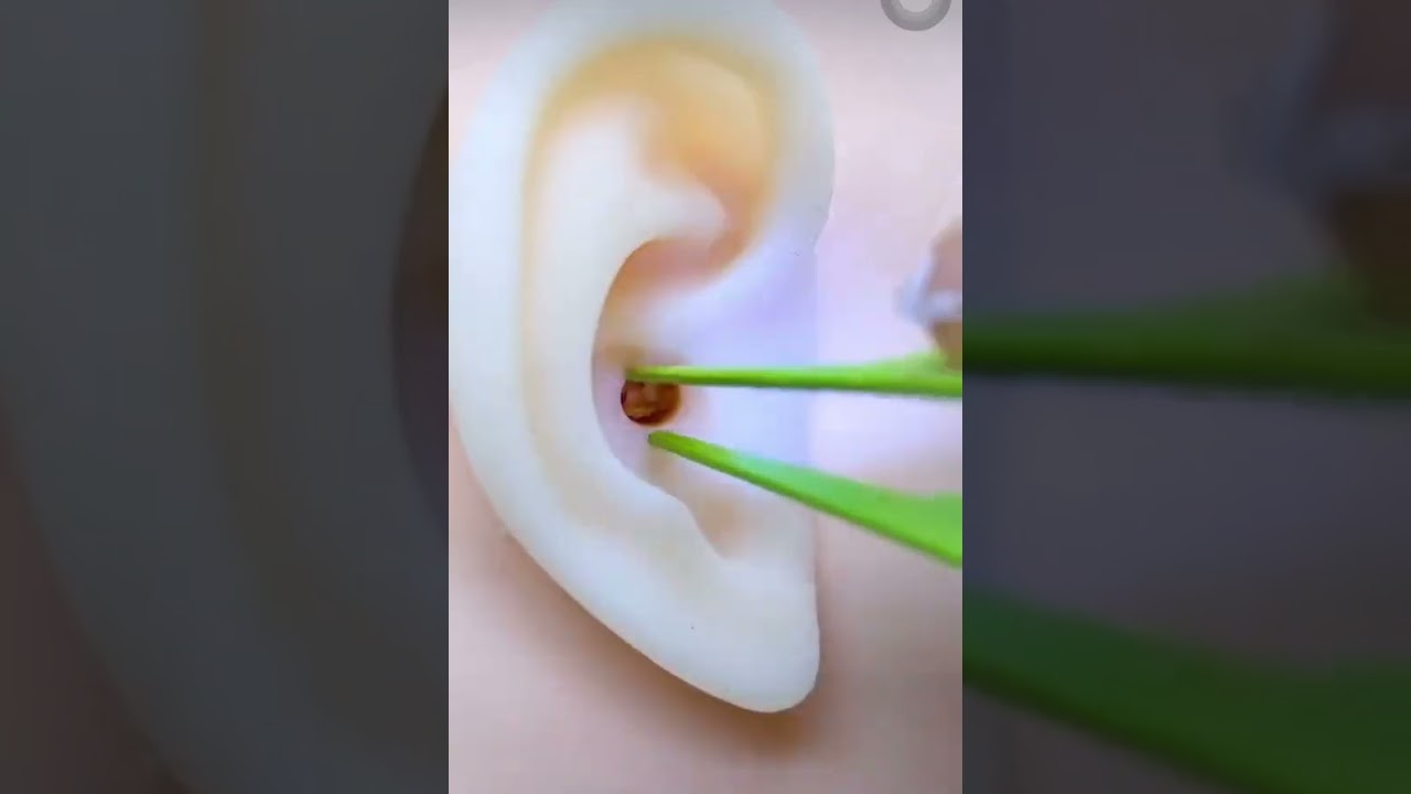 4 Pack Ear Wax Removal Tool Kit with Light, Ear Pick Ear Cleaning Tools Set for Kids and Adults