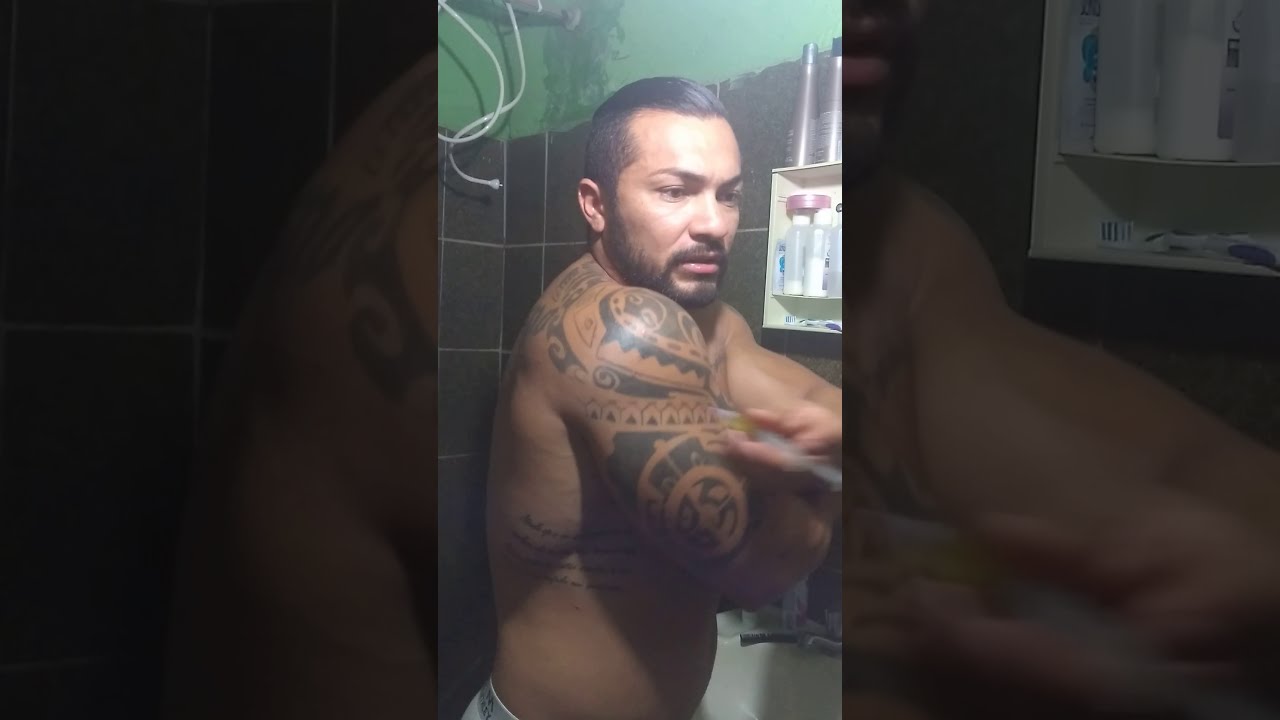 Aplicação no posterior de deltóide