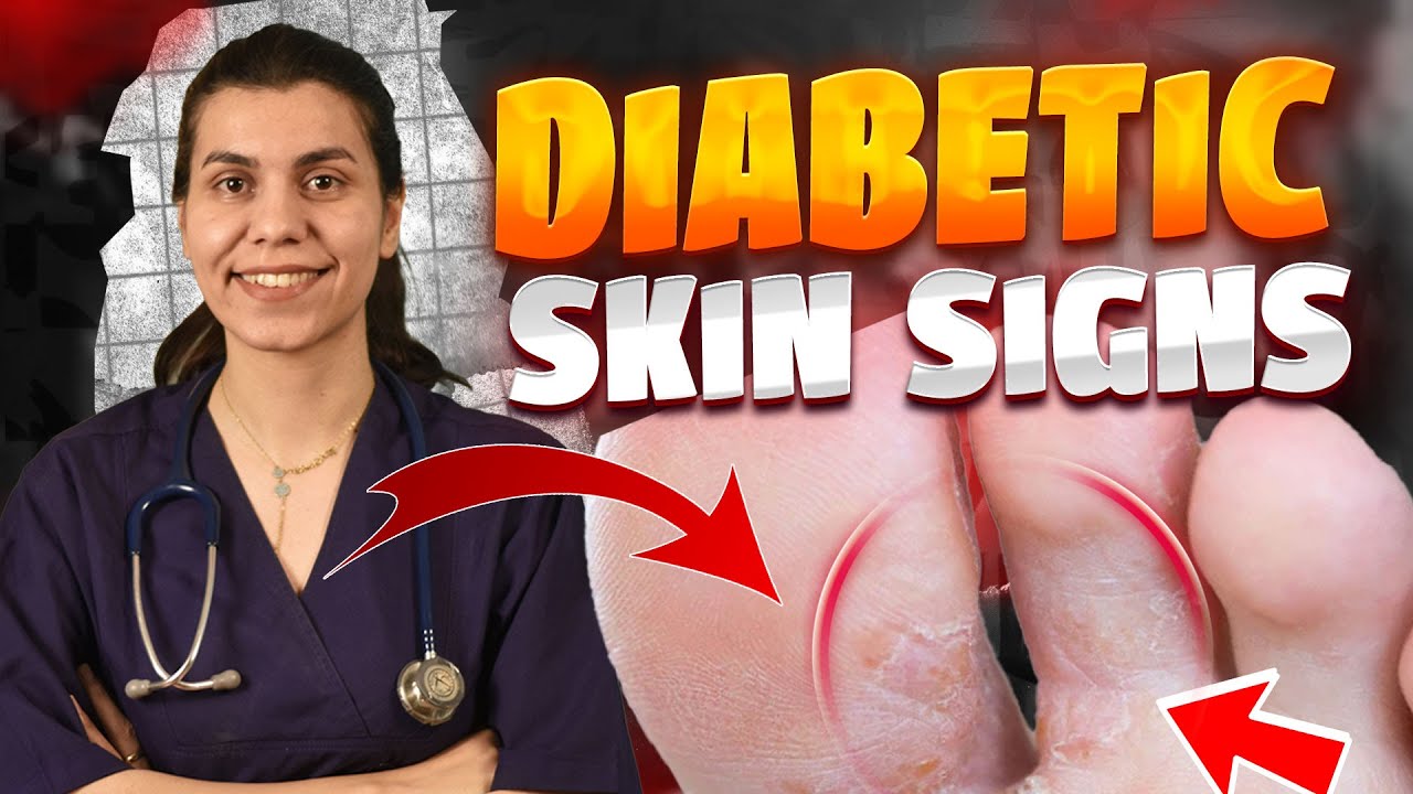 Diabetic Skin Problems & Top Signs of Diabetes on The Skin!