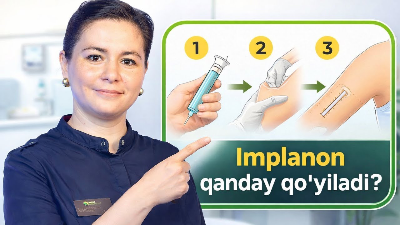 Qo‘lga Spiral Qo‘yish (Implanon): Implant Spiral Qo'yish Jarayoni