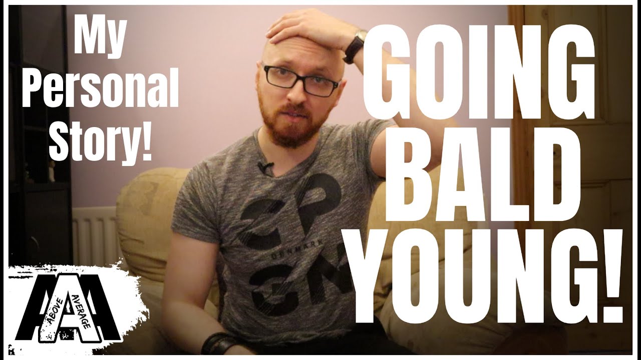 GOING BALD YOUNG?? My Personal Story And Tips For Being Bald!