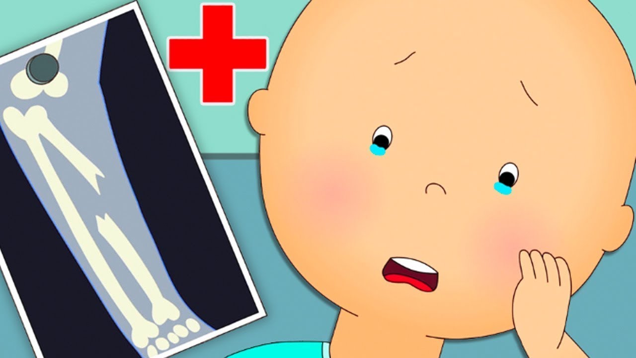 Caillou’s Gebrochener Knochen | Die Neuen Abenteuer von Caillou | Caillou auf Deutsch